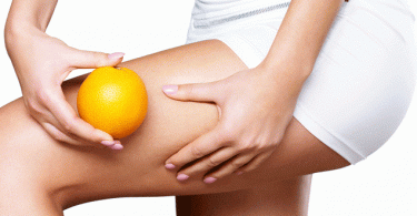 cellulite-peau-orange